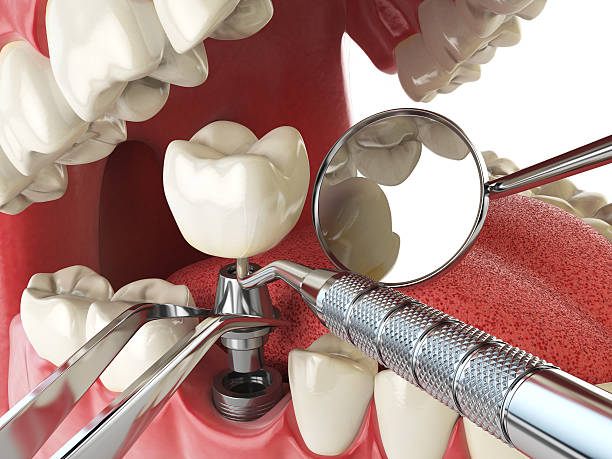 Best Orthodontic Emergency Dentist in Radford, VA